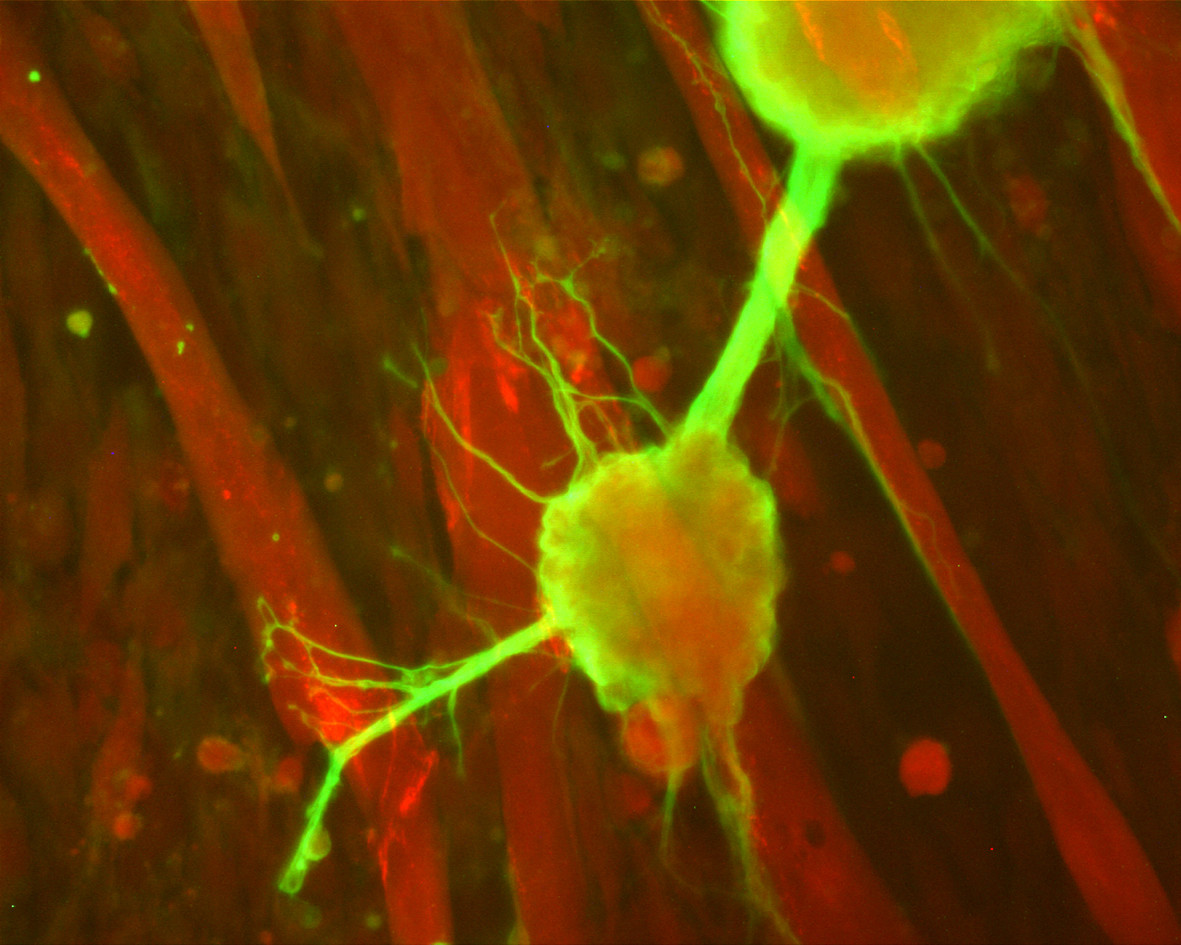 Nerve cells derived from human stem cells