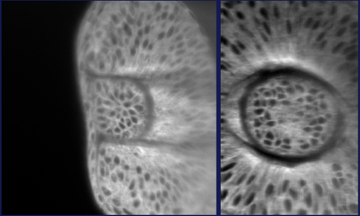 Orthographical views of a developing (~2.5 days post fertilisation) eye in a Zebrafish.