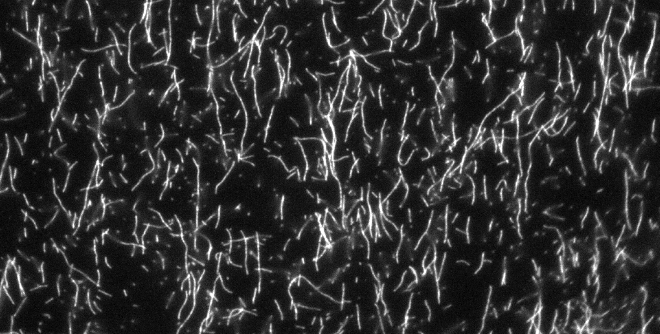 Total Internal Reflection Microscopy of Actin filaments in in Vitro